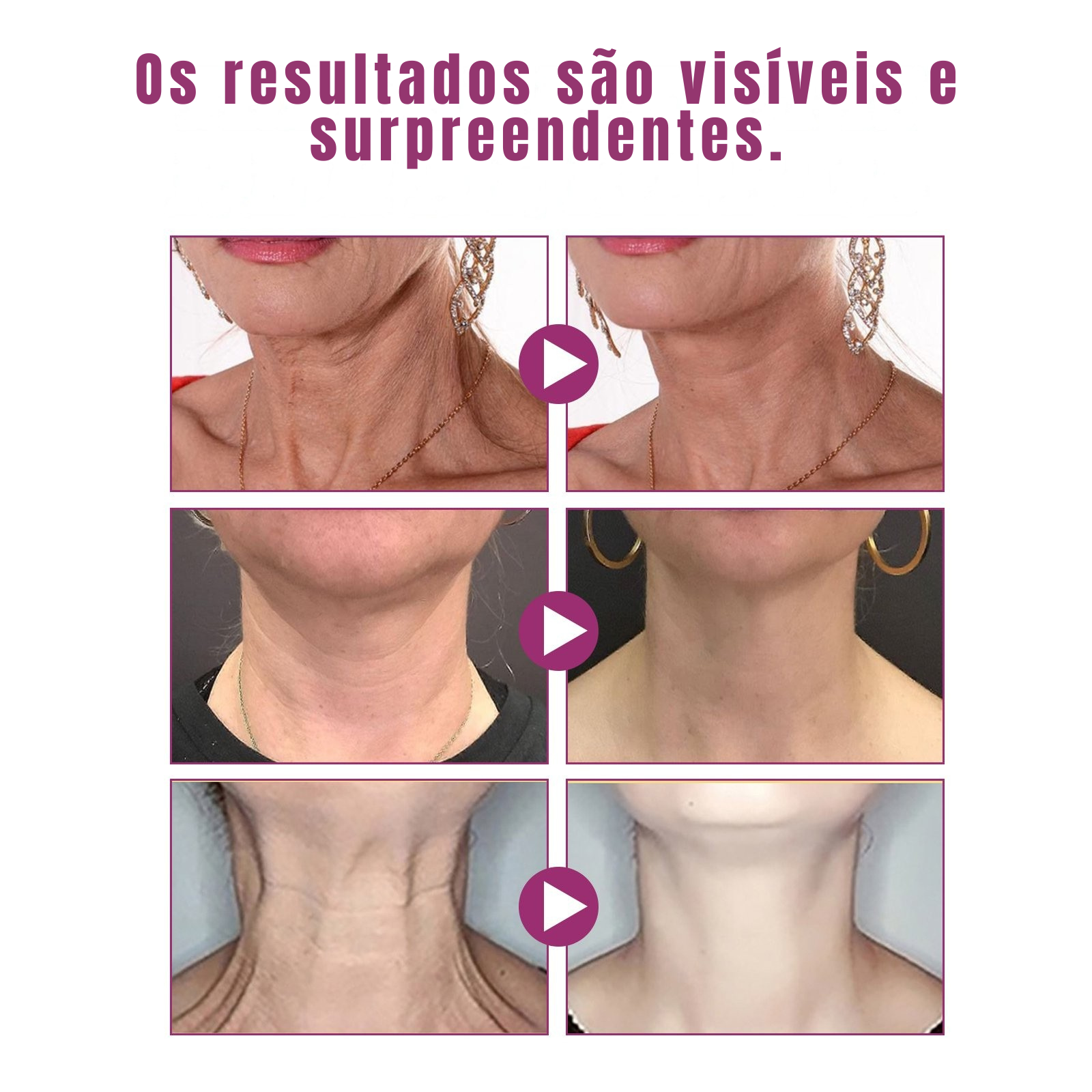 JAYSUING – Creme Coreano Antirrugas Pescoço & Papada