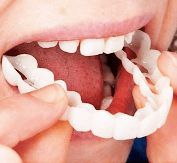 Sorriso Perfeito™ – Próteses Dentárias Removíveis