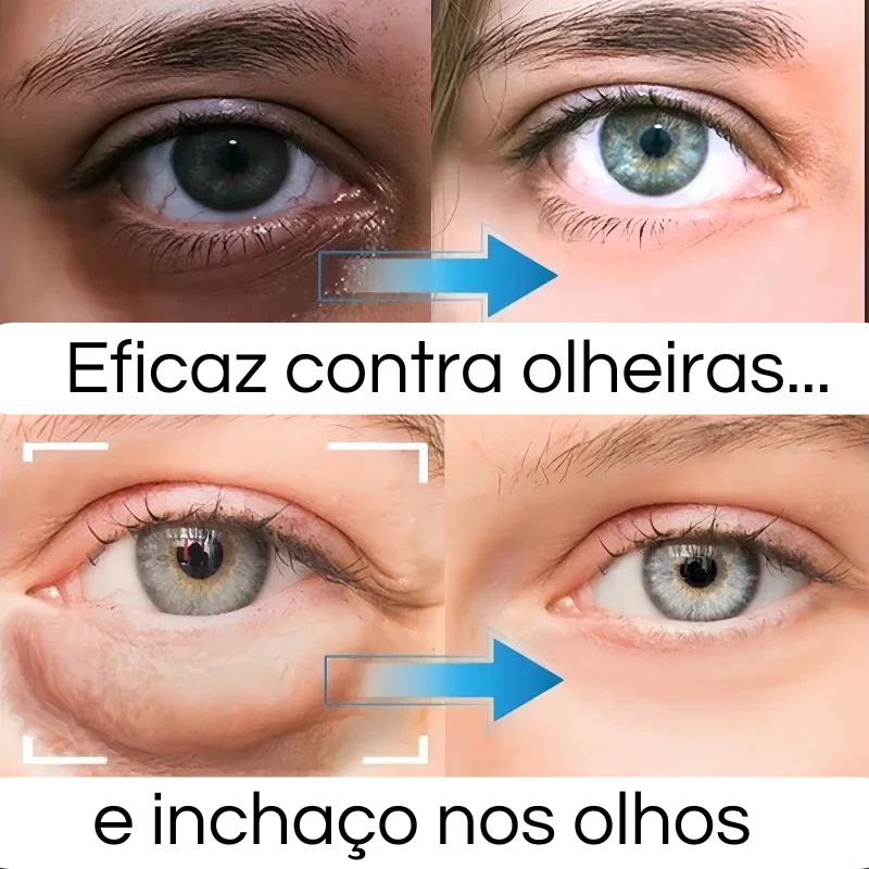 LumiEyes Collagen - 3 em 1 + BRINDE