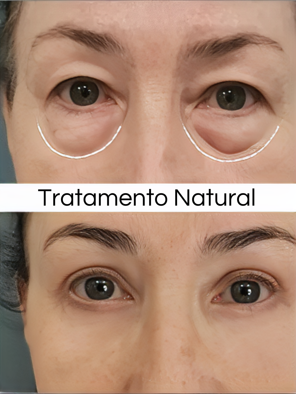 LumiEyes Collagen - 3 em 1 + BRINDE